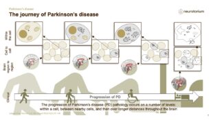 Parkinsons Disease – Course Natural History and Prognosis – slide 3